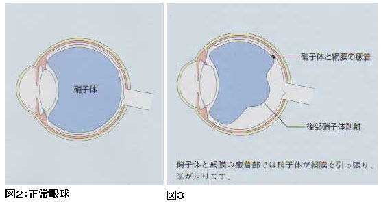 閃輝 暗 点 放置